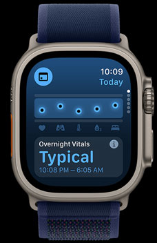 The vitals app displaying someoneʼs health metrics.